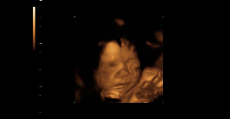 Florida Moves to Protect Unborn Children