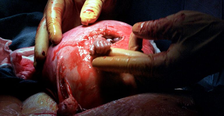 This Photo Inspired a Book, Film and Pro-Life Message Across the Globe