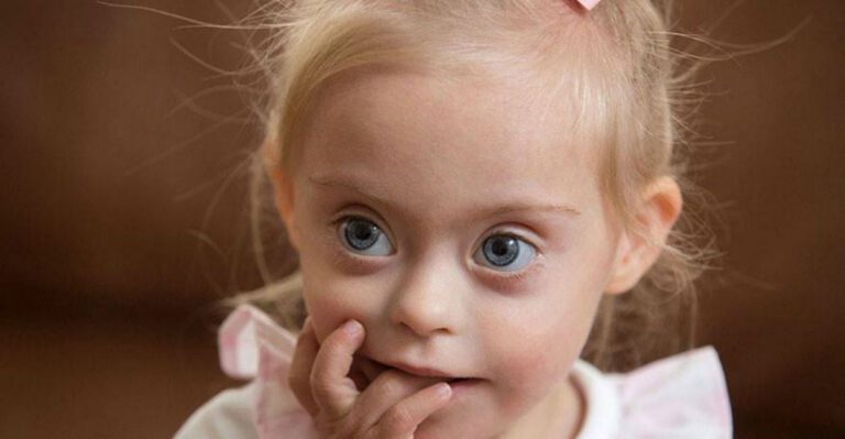 23-Month-Old Model With Down Syndrome Melts Hearts With Adorable Photos