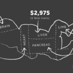 In the Market for Fetal Body Parts, a Baby’s Brain Sells for $3,340