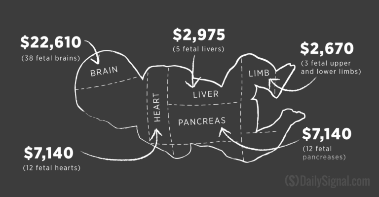 In the Market for Fetal Body Parts, a Baby’s Brain Sells for $3,340