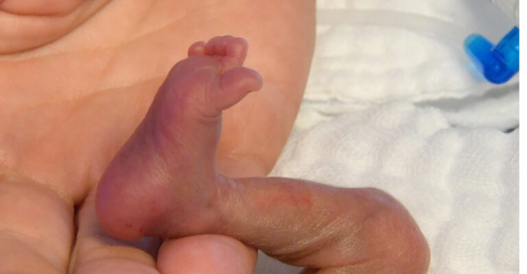 To Prevent Painful Suffering for Children, Late-Term Abortion Should Be Banned