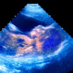 The War on Motherhood: Why the Left Wants to Erase Moms