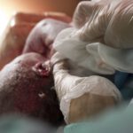Another Chance at Life: How Doctors Can Fix a Birth Defect During Delivery