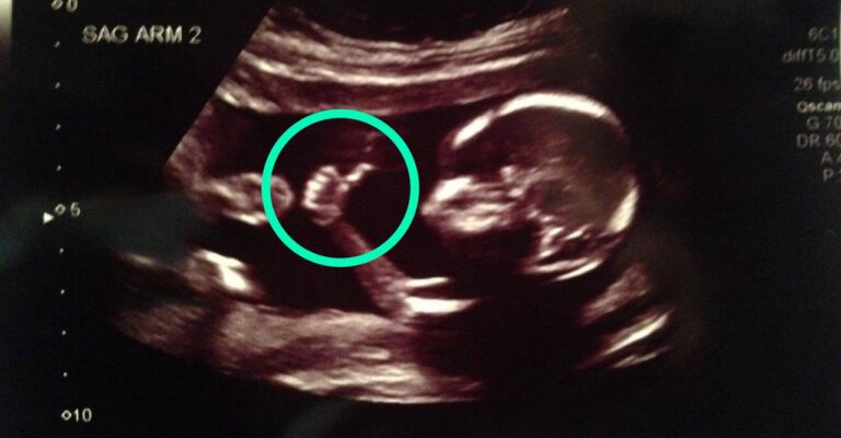 This Might Be the Cutest Ultrasound Photo Ever