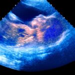 Pro-Life ‘Trigger’ Laws Take Effect in Idaho, Tennessee, Texas