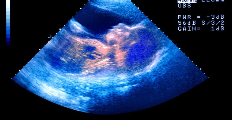 Floridians Challenge Radical Abortion Amendment After Report Reveals Fraud in Petition Process