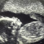 EXCLUSIVE: Midwife Conference Bans Pro-Life OB-GYNs Amid Threats to Decertify Those Who Spread Abortion 'Misinformation'